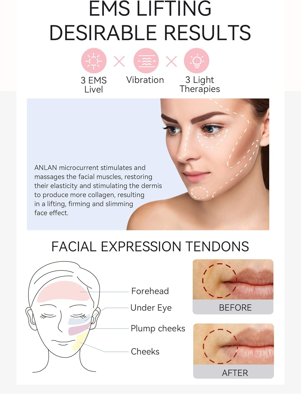 ANLAN Masajeador Facial Para Antiarrugas Y Reafirmante, 5EN1 Maquina Estetica Antienvejecimiento, Cuidado Facial, Antiflacidez Cara Y Cuello, Limpieza Profunda, Con Algodón