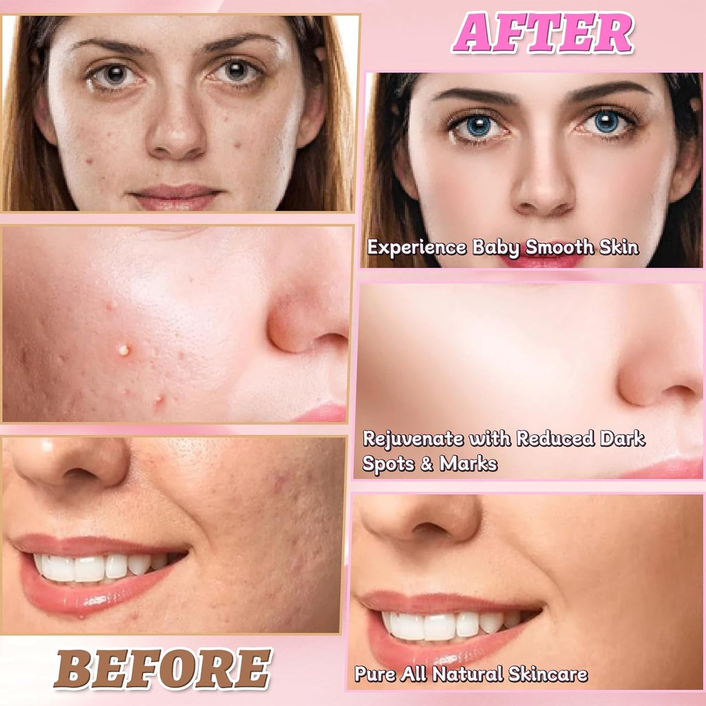 80 Piezas Kojic Acid and Turmeric Cleaning Pad, Turmeric Kojic Acid Exfoliating Cleansing Pads, Ácido Kójico Almohadillas Limpiadoras, Para Limpiar Y Exfoliar, Equilibra El Aceite Y El Agua